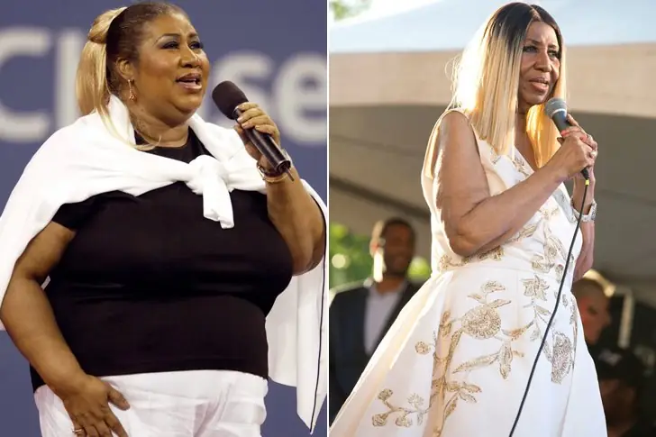 Aretha Franklin – 100 Lbs – Surgery & Healthy Diet