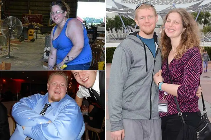 Lisa Berg and Johnathon VanBuskirk – 322 Lbs combined – Tummy Tuck Procedure