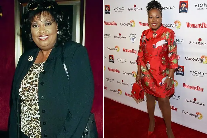 Star Jones – 160 lbs –  Gastric Bypass Surgery