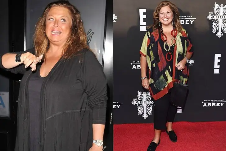 Abby Lee Miller – 100 lbs –  Gastric Sleeve Surgery