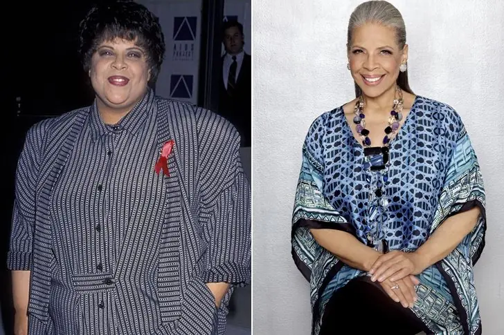 Patti Austin – 120 Lbs – Gastric Bypass Surgery