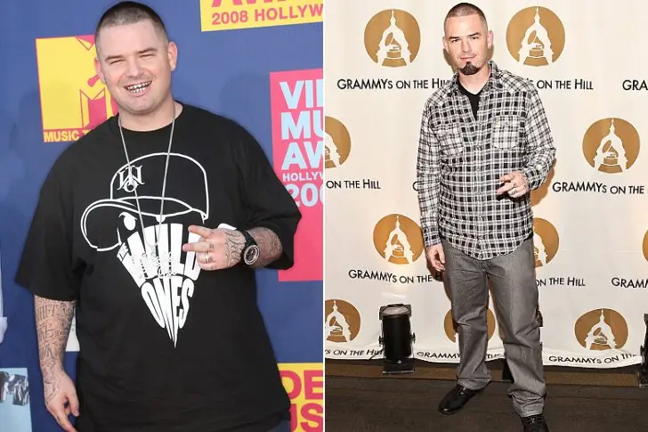 Paul Wall – 10 lbs –  Gastric Sleeve Surgery