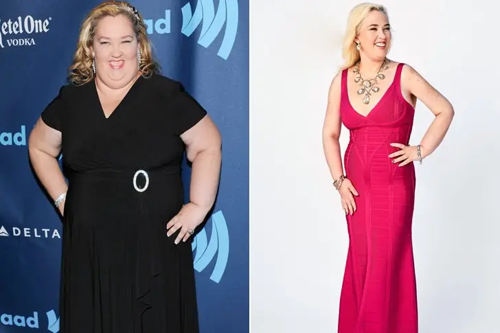 Mama June – 150 Lbs – Gastric Sleeve Surgery, Workout & Diet