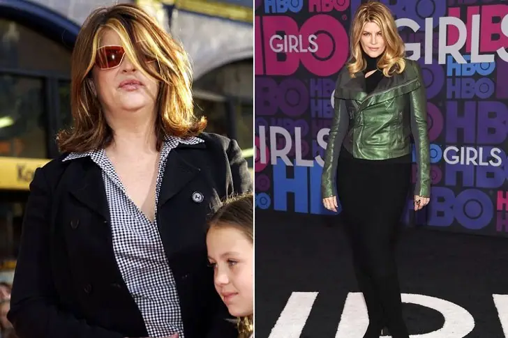 Kirstie Alley – 50 lbs –  Portion Control & Workout