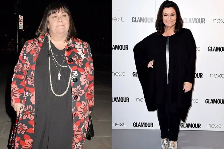 Dawn French – 105 lbs –  Low-Calorie Diet & Walking